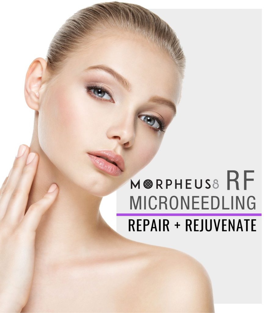 Morpheus 8 treatment