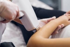 Laser Hair Removal