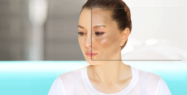 Hyperpigmentation & Sun Damage