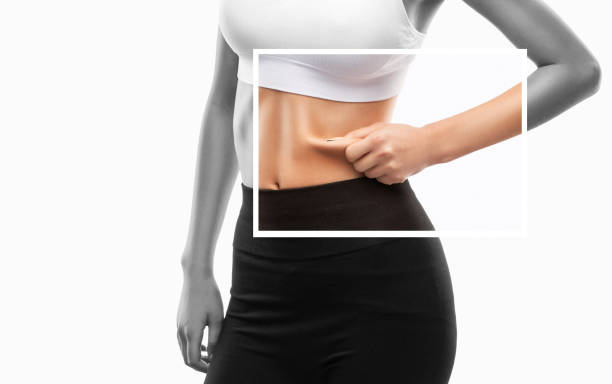 SculpSure