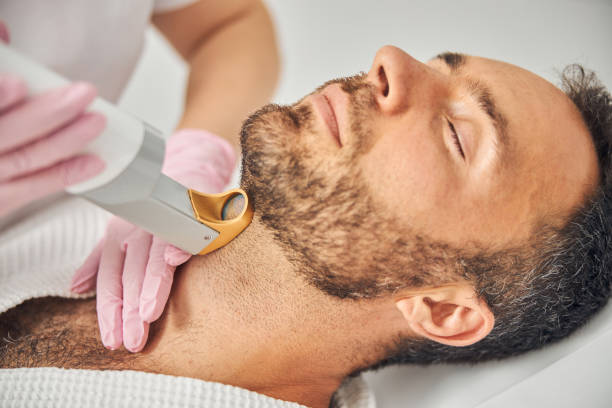 Laser Hair Removal for Men